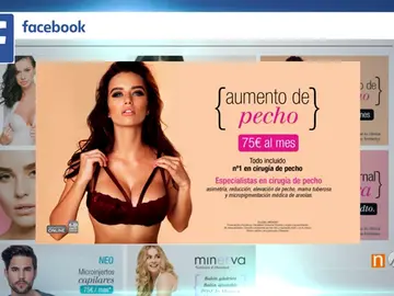 Frame 61.479352 de: Aumento de la cirugía estética entre los jóvenes por la moda de los selfies y la obsesión por la imagen Frame 61.479352 de: Aumento de la cirugía estética entre los jóvenes por la moda de los selfies y la obsesión por la imagen