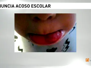 Frame 130.124735 de: ACOSO Frame 130.124735 de: ACOSO