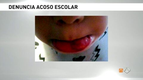 Frame 130.124735 de: ACOSO