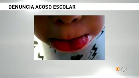 Frame 130.124735 de: ACOSO Frame 130.124735 de: ACOSO