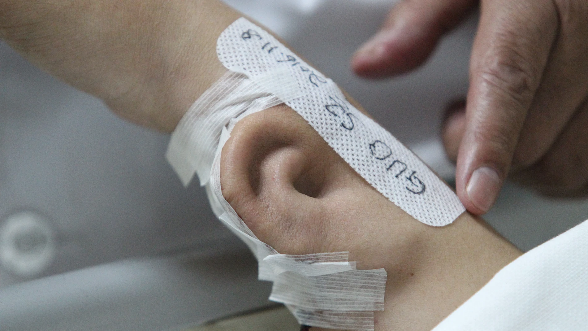 Crean una oreja en el brazo Crean una oreja en el brazo