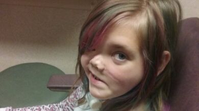 Una niña que perdió media cara en un accidente puede volver a sonreír tras una reconstrucción facial 