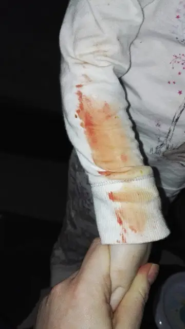 Las manchas de sangre de la pequeña Las manchas de sangre de la pequeña