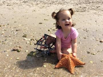 Sophia se sometió a un alargamiento de pierna 