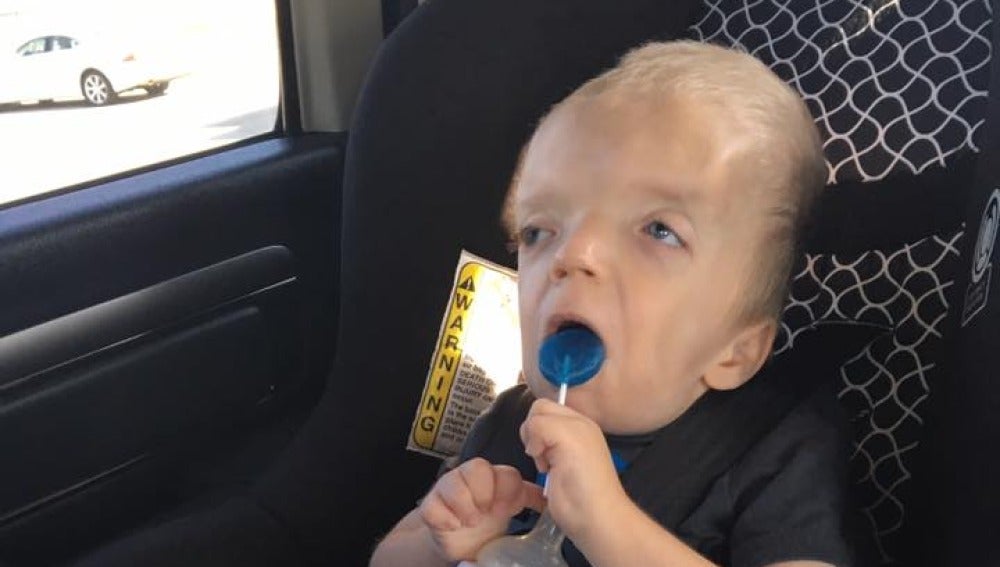 Grayson, el niño con enfermedad terminal del que se están haciendo memes