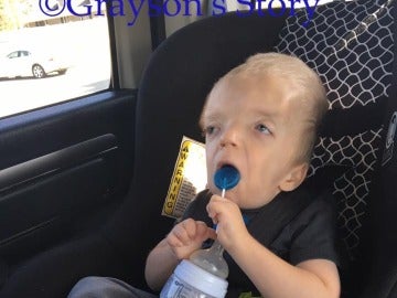 Grayson, el niño con enfermedad terminal del que se están haciendo memes