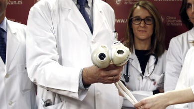 ¿Cómo funciona un corazón artificial? Así es el proceso para aumentar la esperanza de vida de los afectados