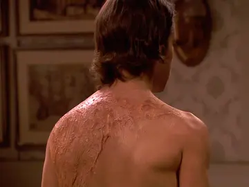 ¿Por qué tiene estas marcas en la espalda Ismael? ¿Por qué tiene estas marcas en la espalda Ismael?