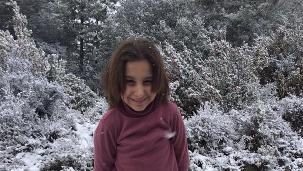 Nadia, la niña con envejecimiento prematuro