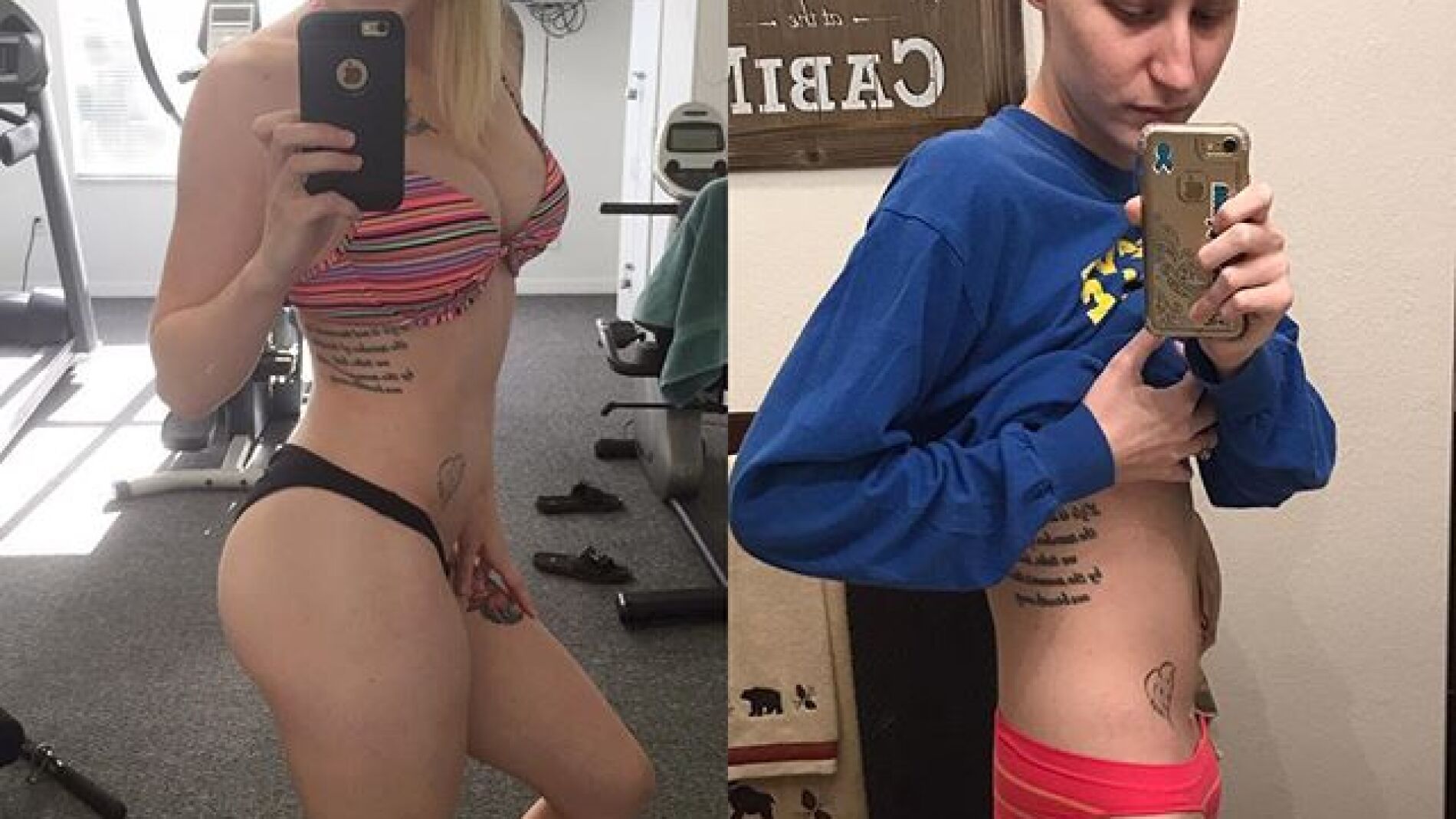 El cuerpo de Cheyann Shaw antes y despu&eacute;s de diagnosticarle la enfermedad