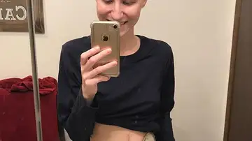 Cheyann Shaw tras la operación a la que se sometió Cheyann Shaw tras la operación a la que se sometió