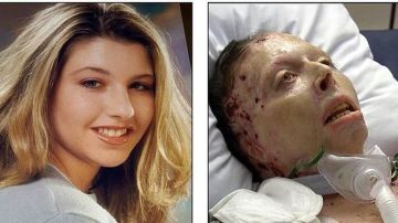 Judy Malinowski, antes y después de haber sido quemada viva por su novio