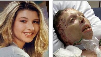 Rechazan que una mujer con el 80% de su cuerpo quemado por el ataque de su novio declare contra él
