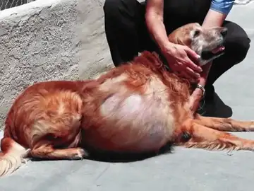 el tumor que tenía Henry pesaba 19 kilos el tumor que tenía Henry pesaba 19 kilos