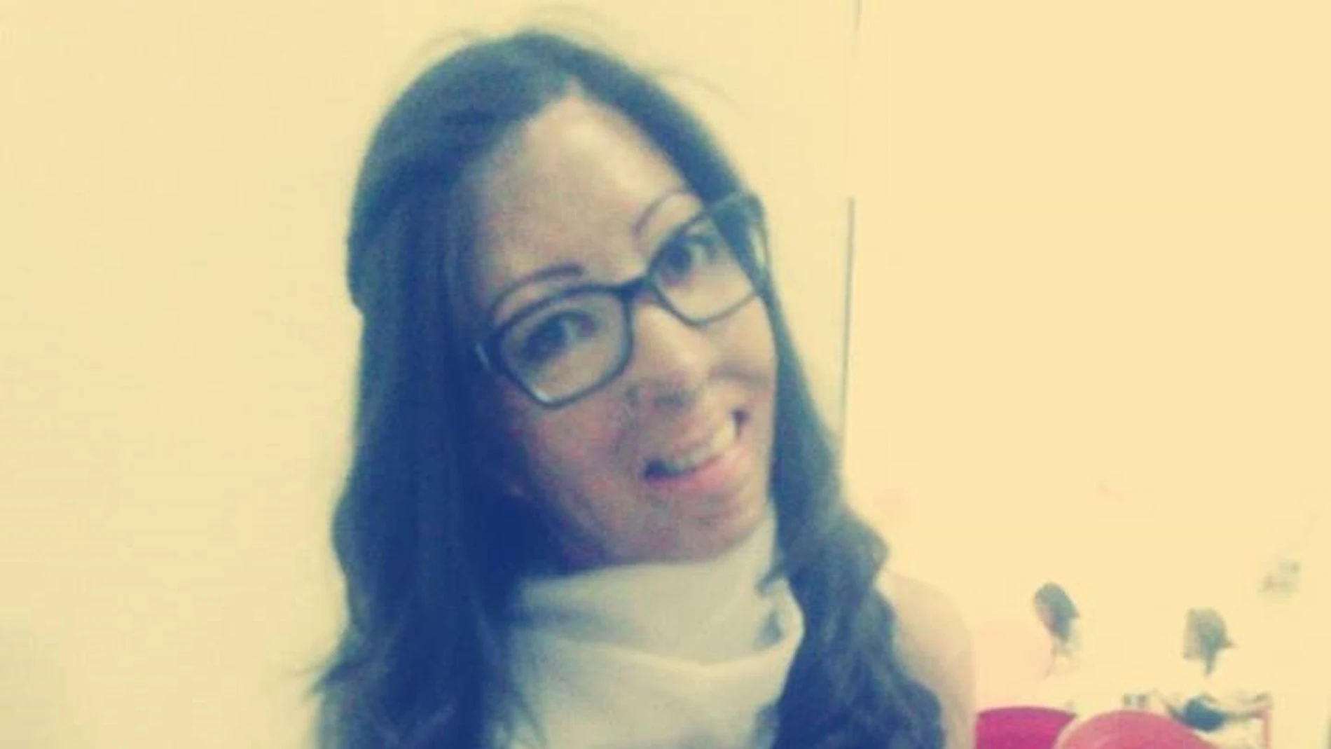 Jenifer Segovia, una joven que sufrió quemaduras en el 47 por ciento del cuerpo durante un incendio provocado por su padrastro cuando ella tenía 10 años Jenifer Segovia, una joven que sufrió quemaduras en el 47 por ciento del cuerpo durante un incendio provocado por su padrastro cuando ella tenía 10 años