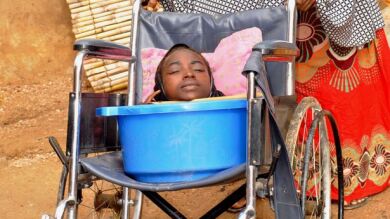 Muere la joven nigeriana sin extremidades que vivía en el interior de un recipiente de plástico