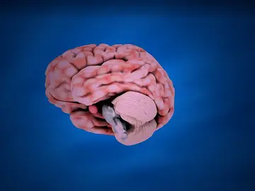 Cerebro Cerebro