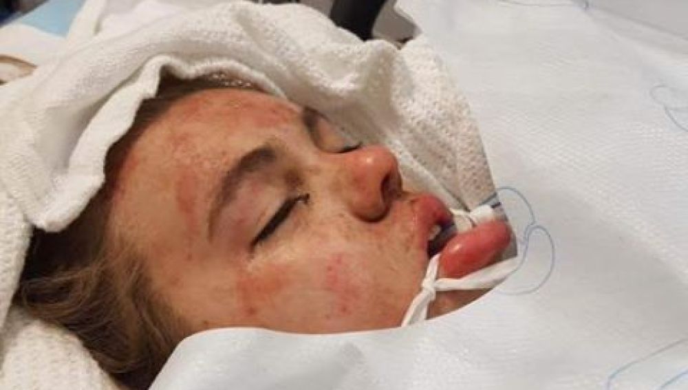 La adolescente en coma tras tomar éxtasis