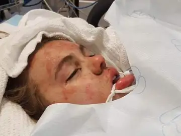La adolescente en coma tras tomar éxtasis La adolescente en coma tras tomar éxtasis
