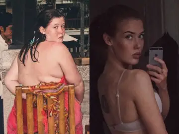 El antes y después de Mathilde Broberg El antes y después de Mathilde Broberg