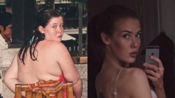 El antes y después de Mathilde Broberg