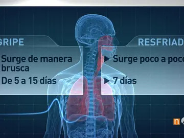 Frame 102.69 de: La gripe colapsa los hospitales españoles, una epidemia que afecta especialmente al norte peninsular Frame 102.69 de: La gripe colapsa los hospitales españoles, una epidemia que afecta especialmente al norte peninsular