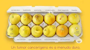 #KnowYourLemons: Una imagen con doce limones para aprender a detectar el cáncer de mama #KnowYourLemons: Una imagen con doce limones para aprender a detectar el cáncer de mama