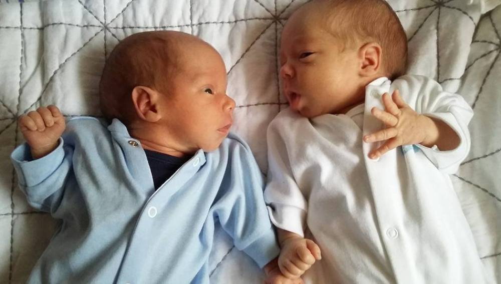 Imagen de los gemelos de Hayley y Charlie