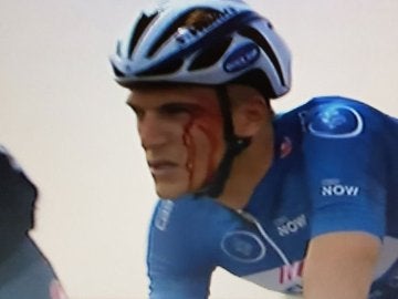 Kittel sangrando durante la carrera tras el puñetazo de Krivko