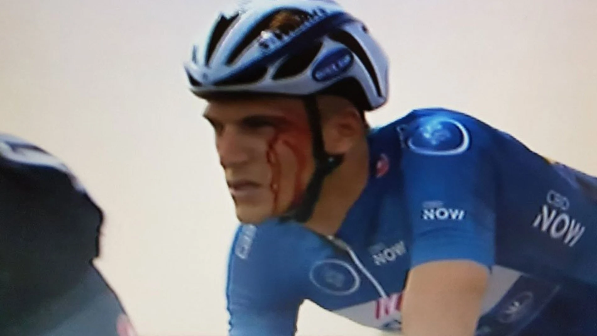 Kittel sangrando durante la carrera tras el puñetazo de Krivko Kittel sangrando durante la carrera tras el puñetazo de Krivko