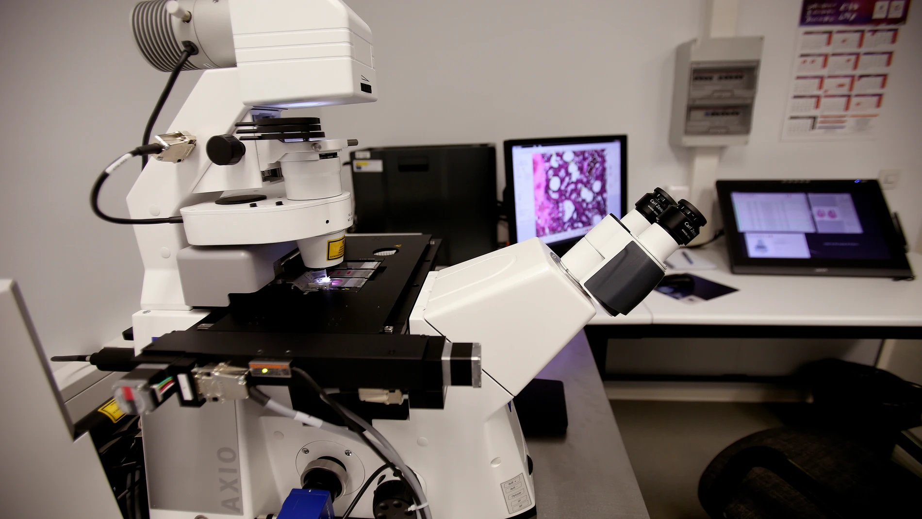 Microscopio láser que da información concreta sobre células tumorales"del Servicio de Patología Molecular Comparada de Salamanca Microscopio láser que da información concreta sobre células tumorales"del Servicio de Patología Molecular Comparada de Salamanca