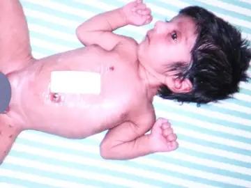 El pequeño se recupera tras la operación El pequeño se recupera tras la operación