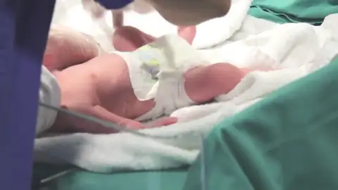 Frame 6.840589 de: Una mujer de 64 años da a luz a gemelos en Burgos tras someterse a una fecundación 'in vitro' Frame 6.840589 de: Una mujer de 64 años da a luz a gemelos en Burgos tras someterse a una fecundación 'in vitro'