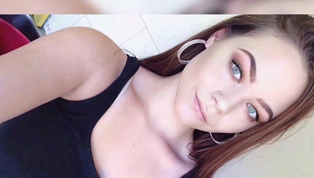Tylah Durie posa una vez recuperada de la reacción alérgica