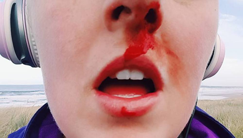 Sarah Tough recibe un duro golpe tras defender a una cría de foca de la tortura de un grupo de niños