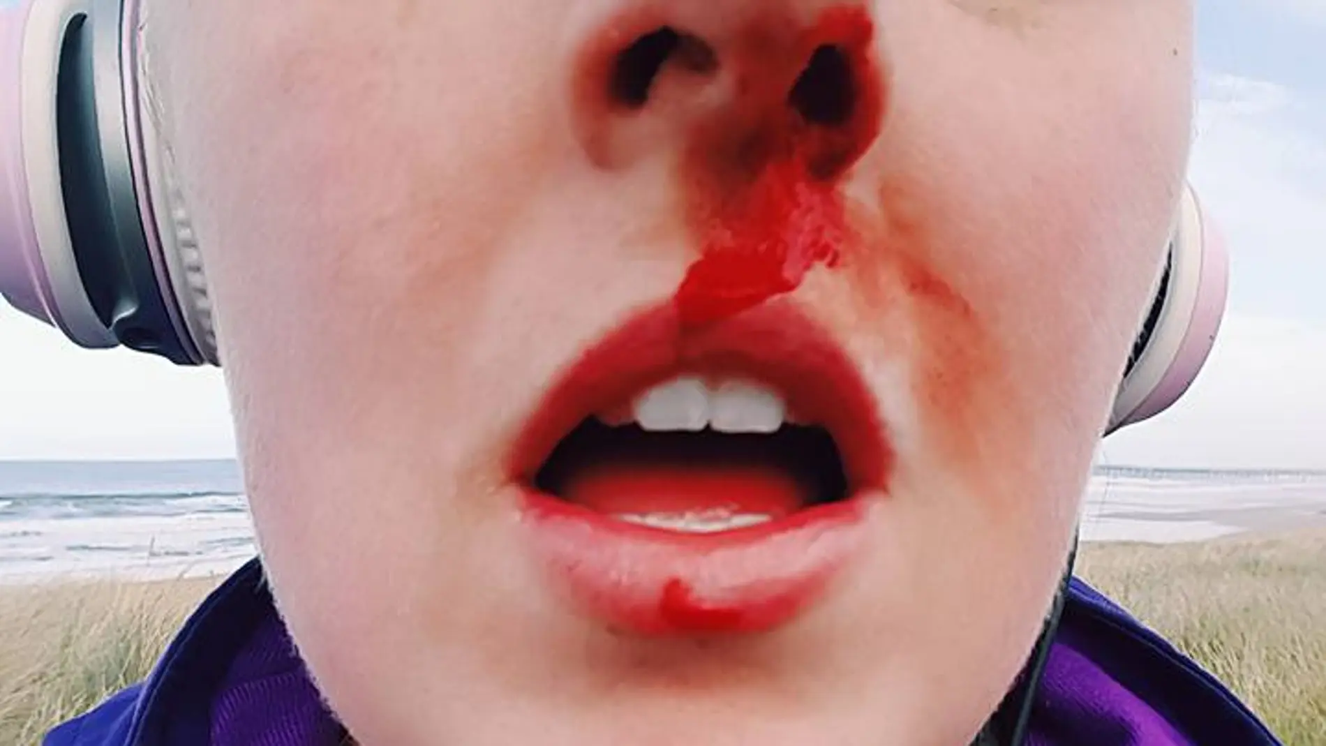 Sarah Tough recibe un duro golpe tras defender a una cría de foca de la tortura de un grupo de niños Sarah Tough recibe un duro golpe tras defender a una cría de foca de la tortura de un grupo de niños