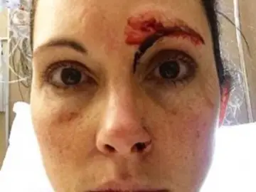 Kelly Herron en la foto publicada después del intento de violación Kelly Herron en la foto publicada después del intento de violación