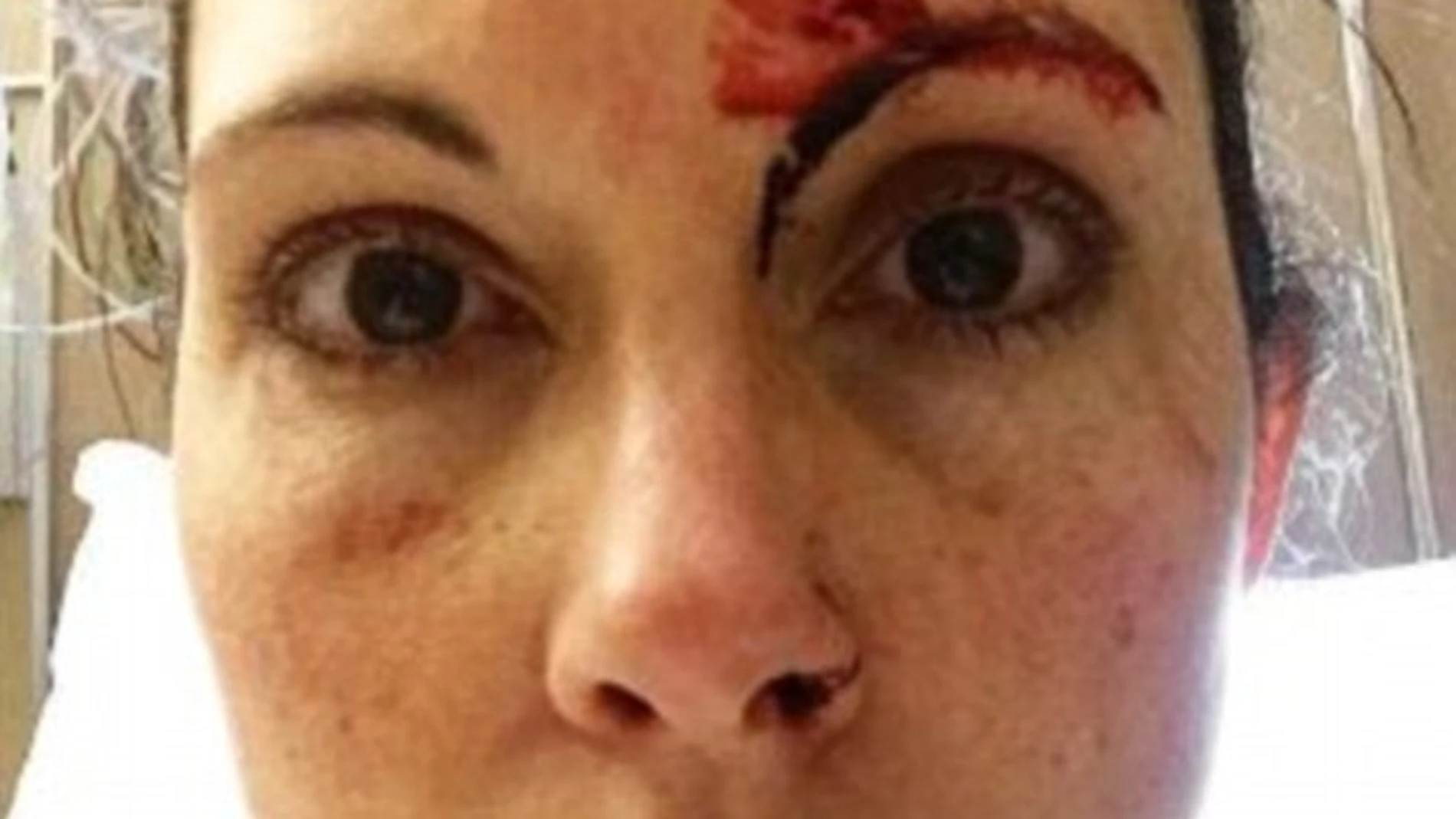 Kelly Herron en la foto publicada después del intento de violación Kelly Herron en la foto publicada después del intento de violación