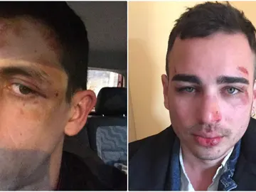 Agresión a dos homosexuales en Barcelona Agresión a dos homosexuales en Barcelona