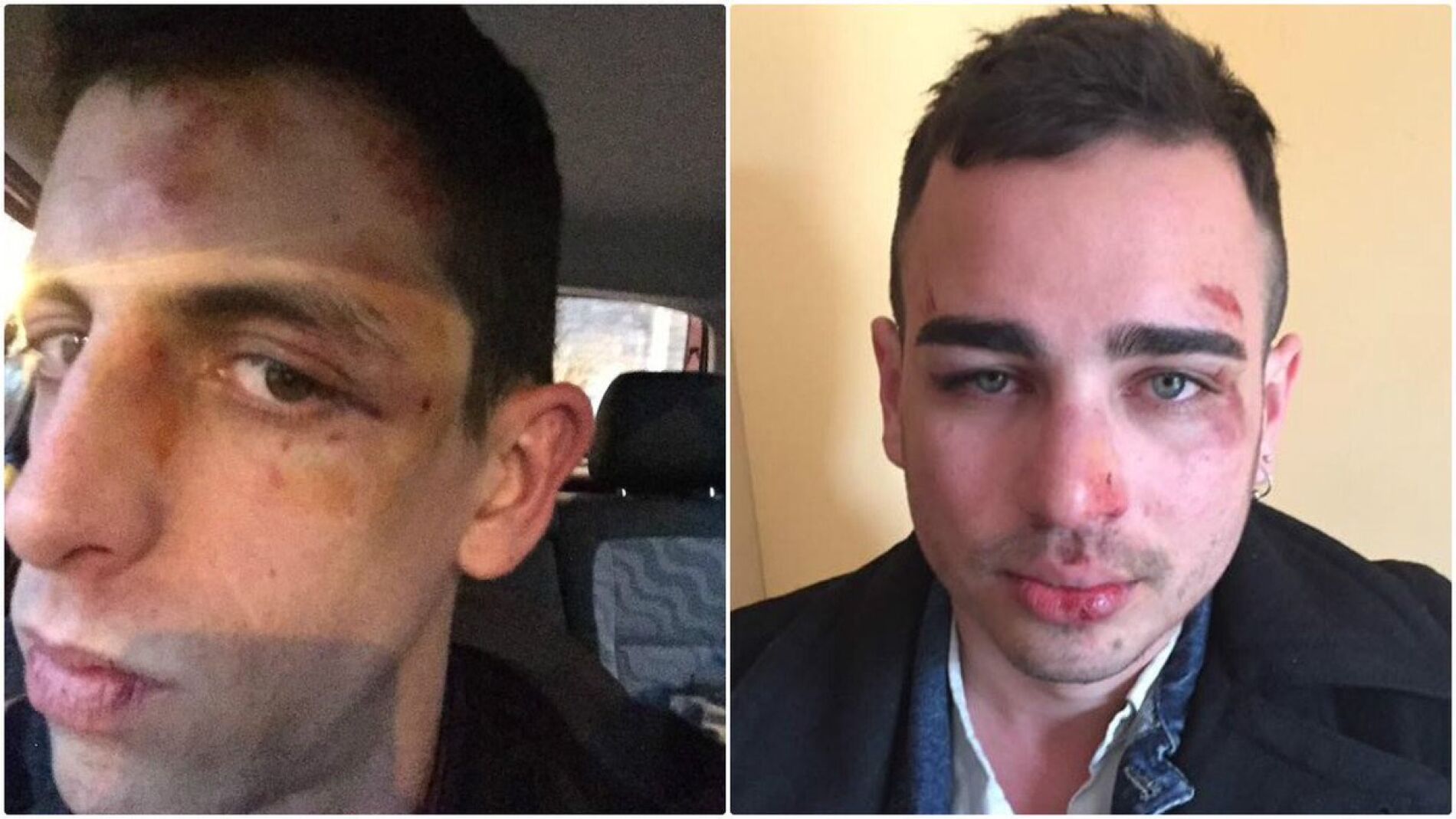 Agresi&oacute;n a dos homosexuales en Barcelona