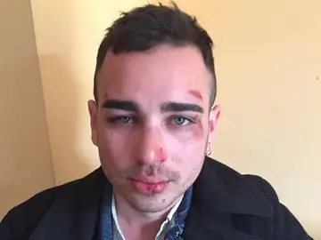 Una pareja homosexual agredida en Berga (Barcelona) Una pareja homosexual agredida en Berga (Barcelona)