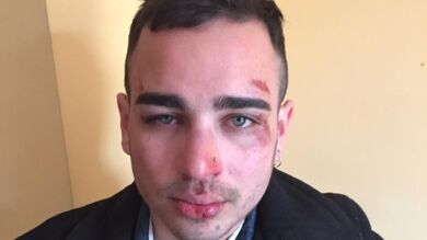 Agreden a dos chicos homosexuales en Barcelona por besarse en público