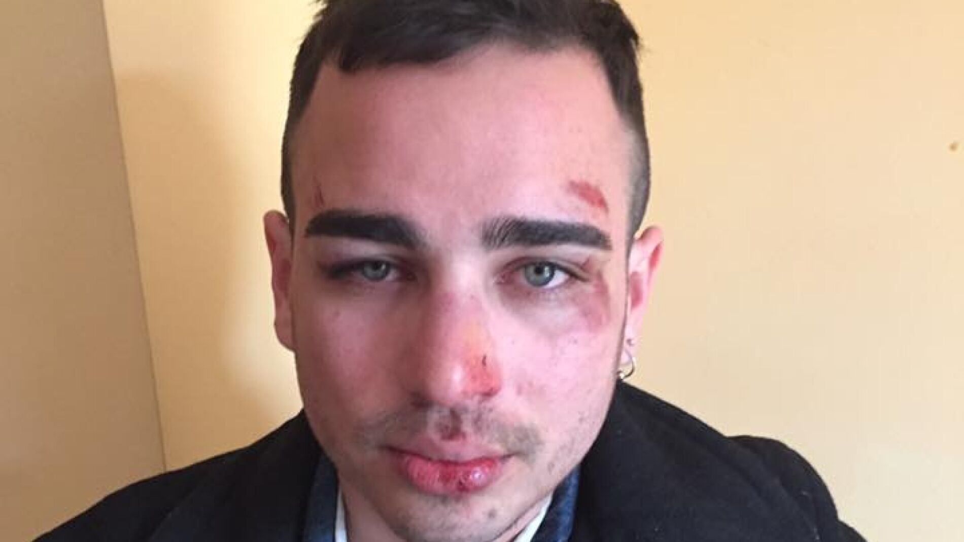 Una pareja homosexual agredida en Berga (Barcelona)