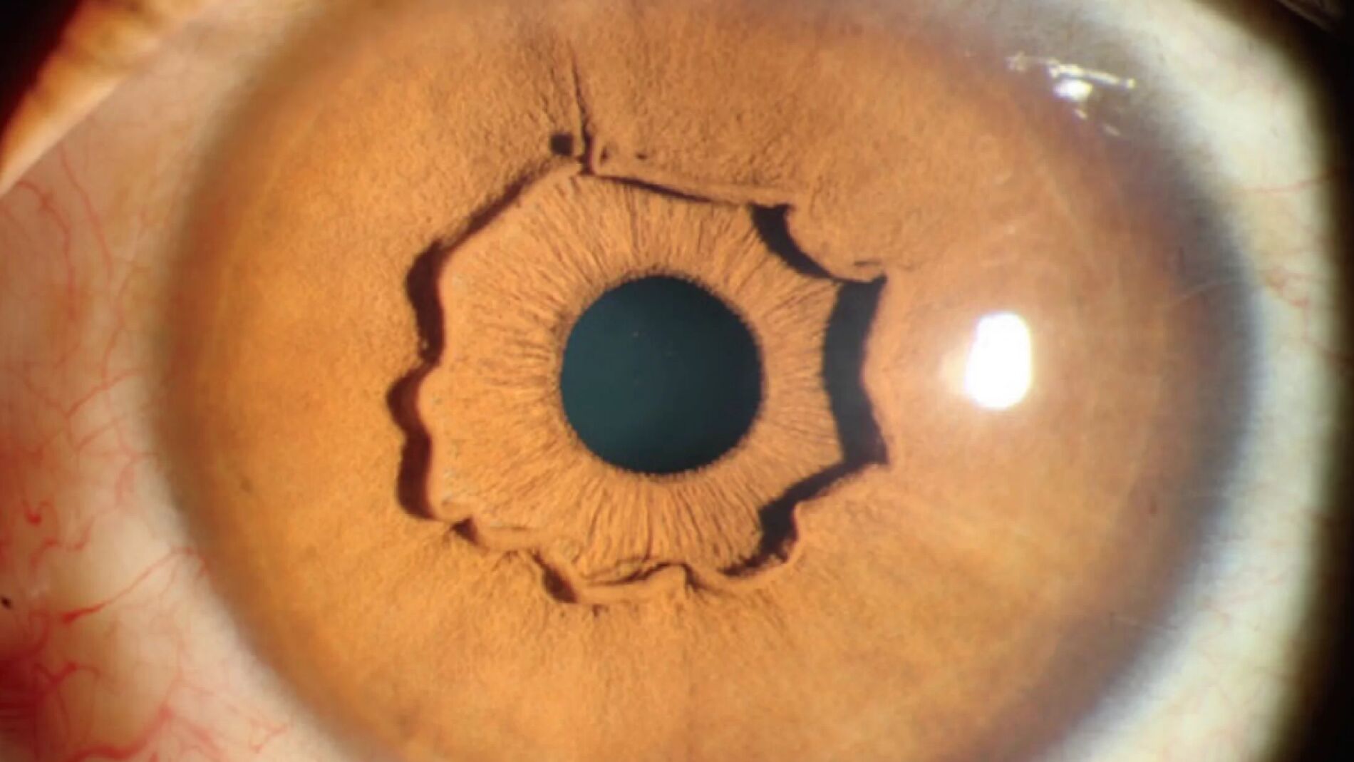 Una extra&ntilde;a forma que sobresale del iris de una mujer china