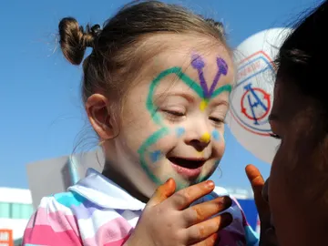 Niña con Síndrome de Down Niña con Síndrome de Down