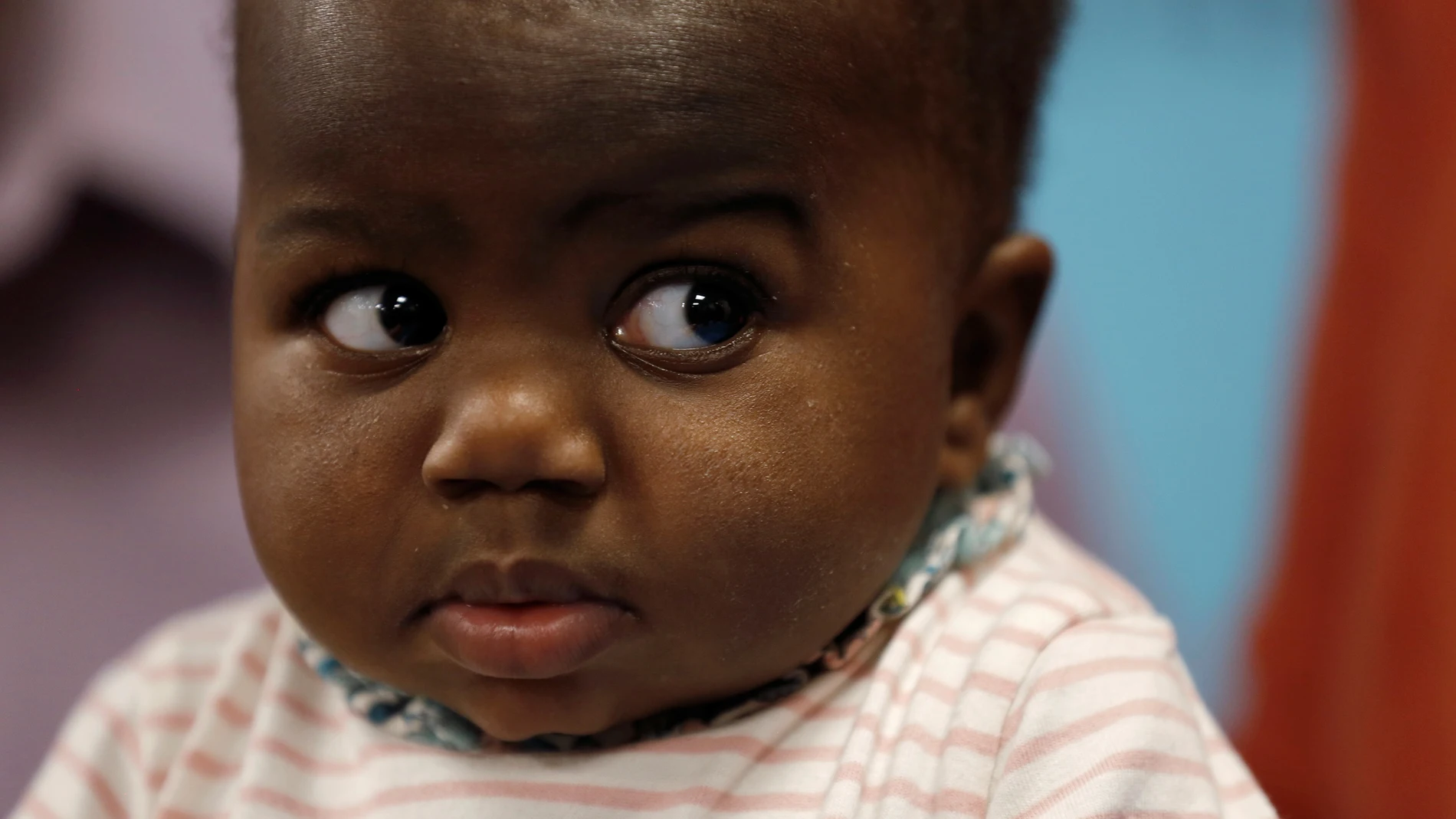 Dominique, la niña que nació con cuatro piernas Dominique, la niña que nació con cuatro piernas