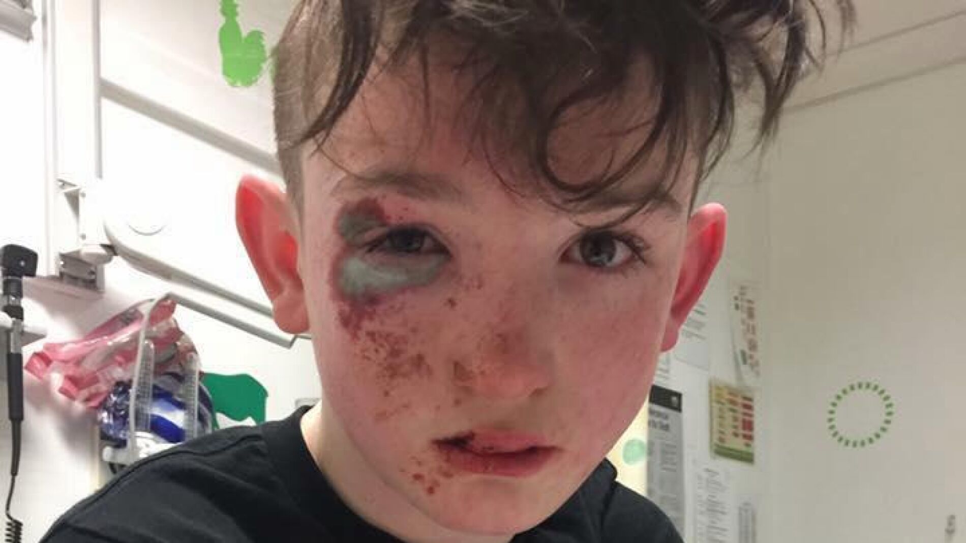 Shane Flower se recupera en el hospital del ataque