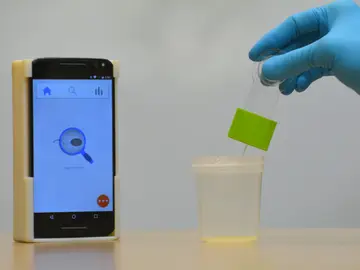 Ya se puede medir la fertilidad del semen con el movil Ya se puede medir la fertilidad del semen con el movil