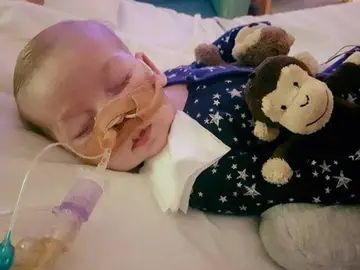 Charlie Gard, el bebé con una enfermedad rara que necesitaba dinero para tratarse en EEUU Charlie Gard, el bebé con una enfermedad rara que necesitaba dinero para tratarse en EEUU