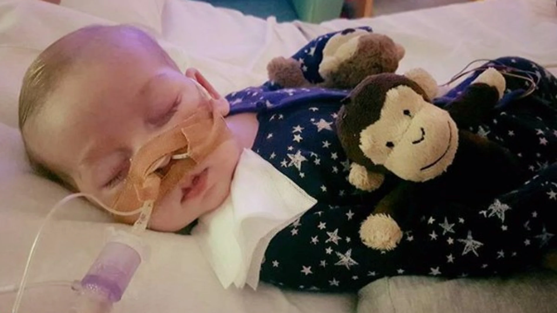 Charlie Gard, el bebé con una enfermedad rara que necesitaba dinero para tratarse en EEUU Charlie Gard, el bebé con una enfermedad rara que necesitaba dinero para tratarse en EEUU
